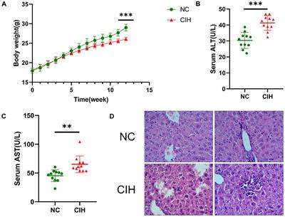 Untargeted Metabolomic Profiling of Liver in a Chronic Intermittent Hypoxia Mouse Model